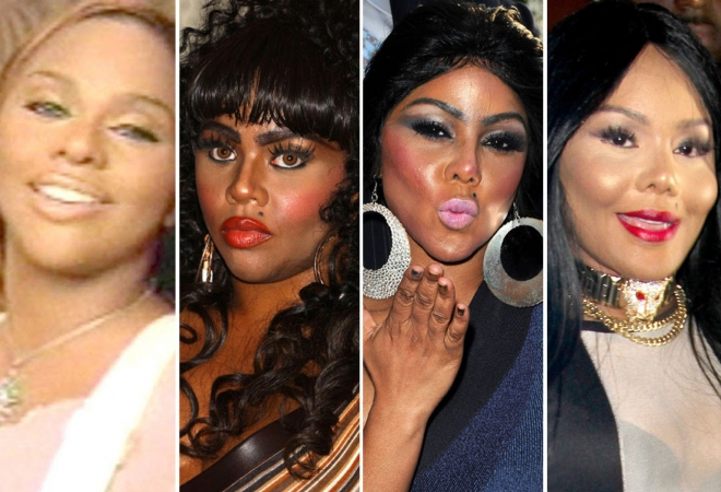 Lil Kim Before and After